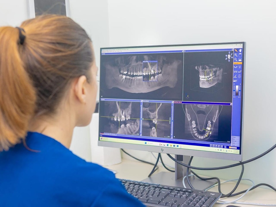 Igienista rivede radiografie 3D